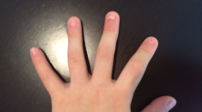 中指の爪